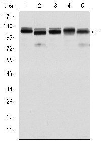 BMPR2 Antibody