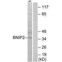 BNIP2 Antibody