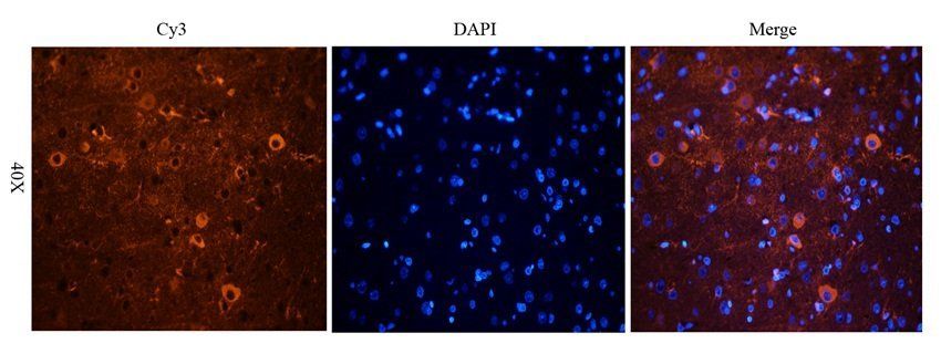 BNP Rabbit Polyclonal Antibody