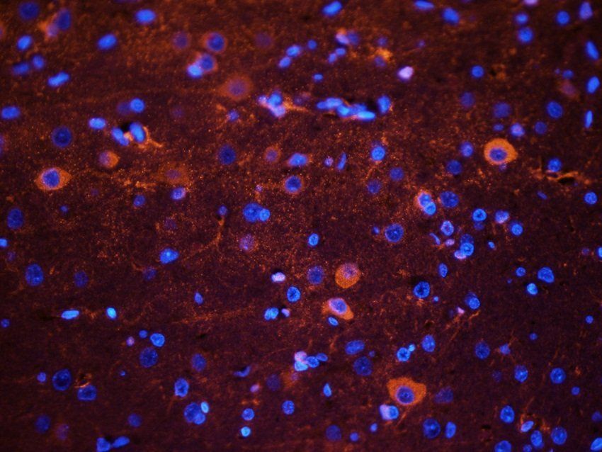 BNP Rabbit Polyclonal Antibody