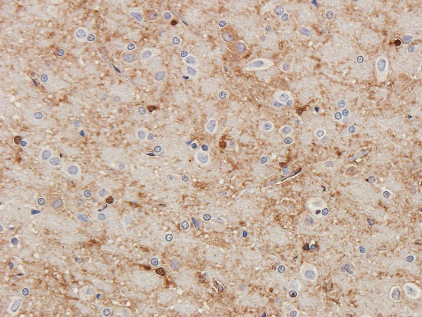 BNP Rabbit Polyclonal Antibody