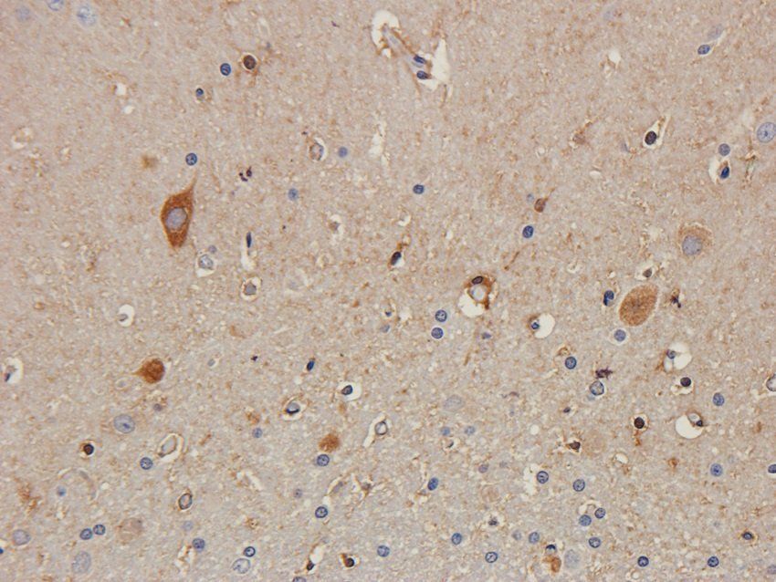 BNP Rabbit Polyclonal Antibody