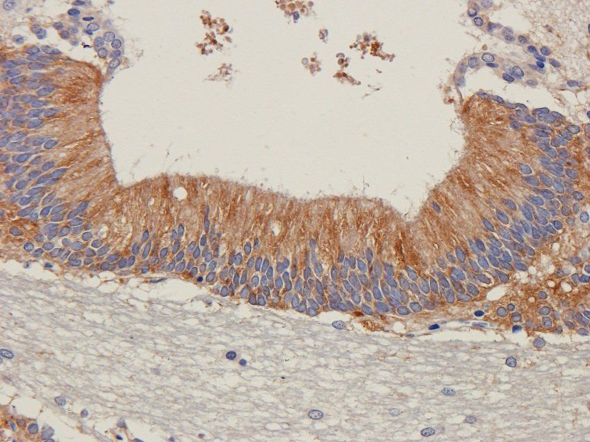 BNP Rabbit Polyclonal Antibody