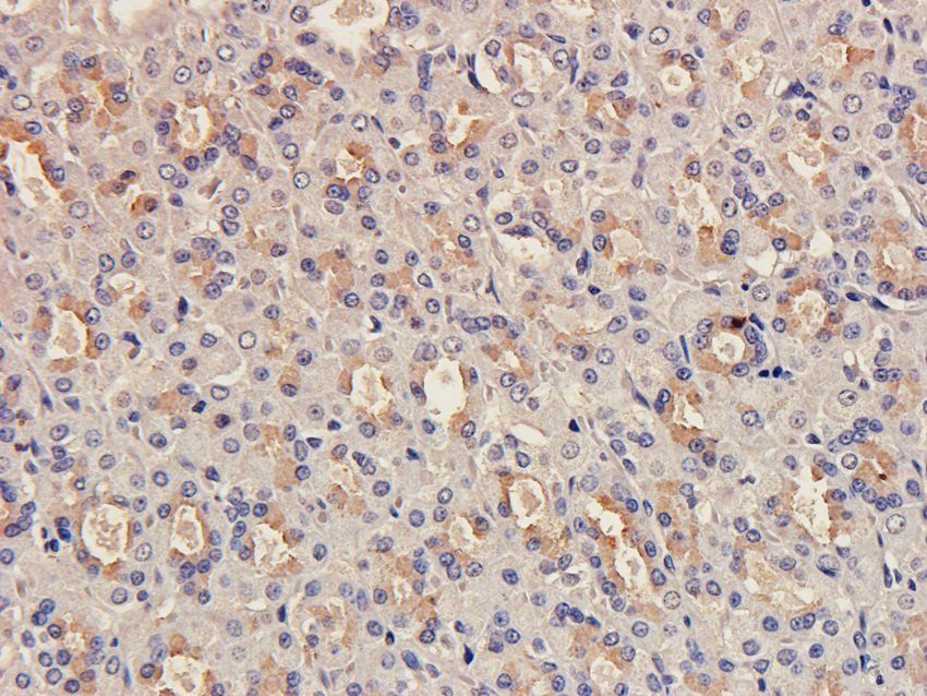 BNP Rabbit Polyclonal Antibody
