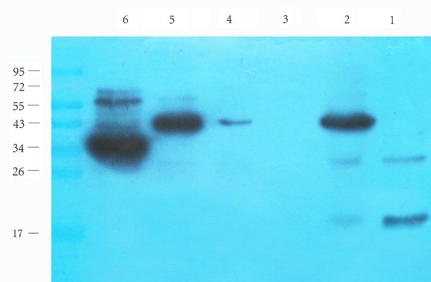 BNP Rabbit Polyclonal Antibody