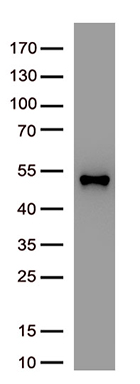 Bone marrow stromal cell antigen 1 (BST1) Mouse Monoclonal Antibody [Clone ID: OTI4E4]