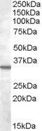 Goat anti-Bradykinin receptor B1 Antibody