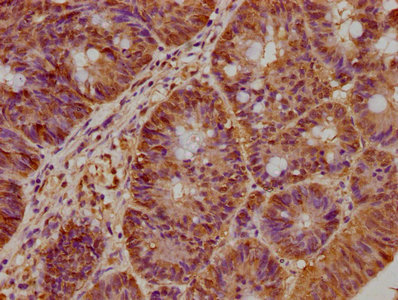 BRAT1 Antibody