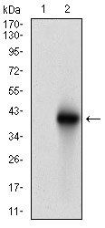 BRCA1 Antibody