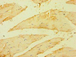 BRCC3 Antibody