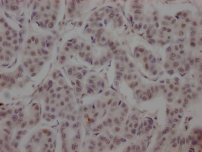 BRD4 Antibody