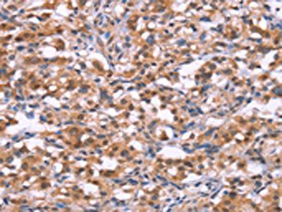 BRK1 Antibody