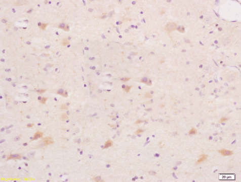 Laminin alpha 5 Rabbit Polyclonal Antibody