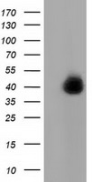 BTK Antibody