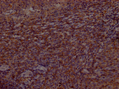 BTK Antibody