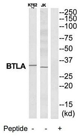 BTLA Antibody