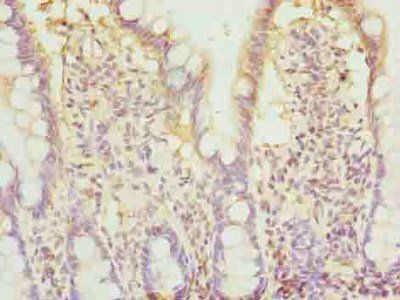 BTN2A2 Antibody