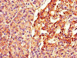 BTRC Antibody