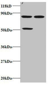 CCL22 Antibody