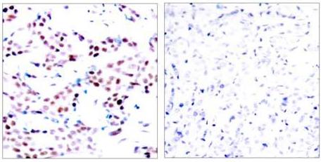 c-Jun (Phospho-Thr91) Antibody