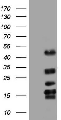 CD117 Antibody
