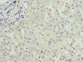 CRP Antibody