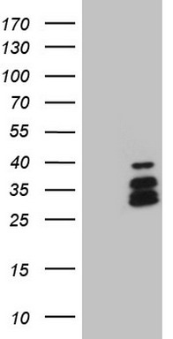C Reactive Protein Antibody