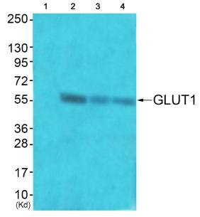 GLUT1 Antibody