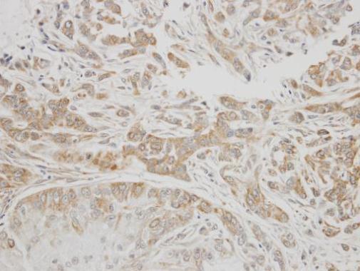serpin family G member 1 Antibody