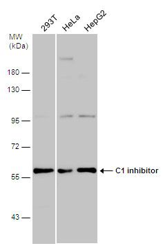 serpin family G member 1 Antibody