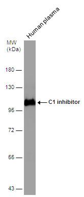 serpin family G member 1 Antibody