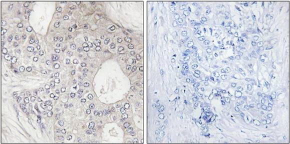 Cytochrome P450 1A2 Antibody