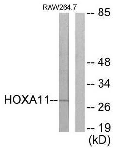 HOXA11/D11 Antibody