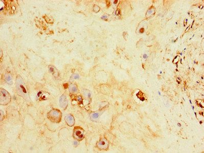 C17orf58 Antibody