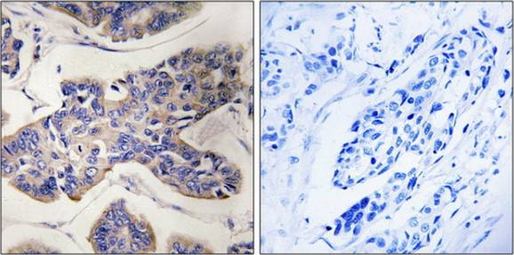 TAOK1 Antibody