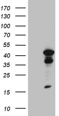 ANGPTL8 Antibody