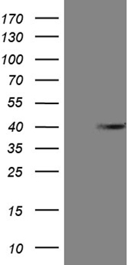 ANGPTL8 Antibody