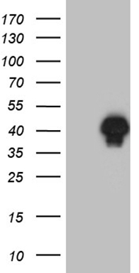 C19orf80 Antibody