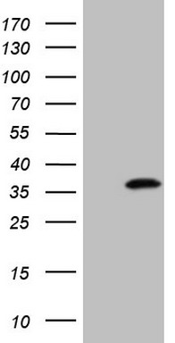 C19orf80 Antibody