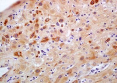 C1GALT1 Rabbit Polyclonal Antibody