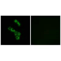 C1QB Antibody