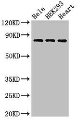 C1R Antibody