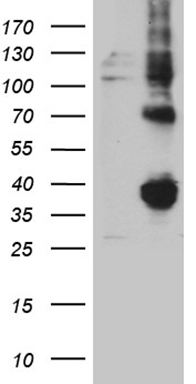 NDUFAF5 Antibody