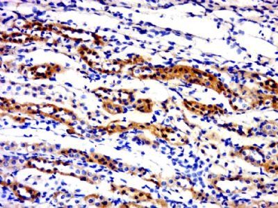 C21ORF62 Rabbit Polyclonal Antibody