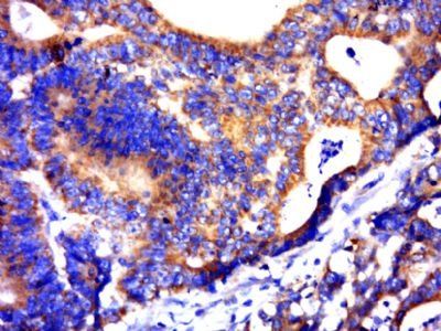 C21ORF62 Rabbit Polyclonal Antibody