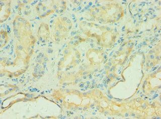 C4BPB Antibody