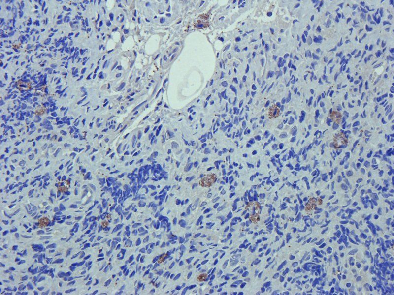 C5a Rabbit Polyclonal Antibody