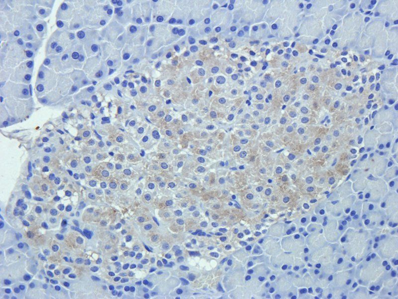 C5a Rabbit Polyclonal Antibody
