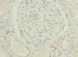 C5orf24 Antibody