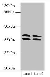 CA10 Antibody